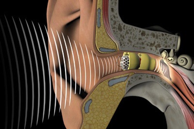 How hearing aid works